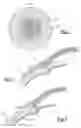 Fig. 02 - Sustained release implantable eye device