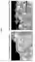 Fig. 08 - Cochleate preparations of fragile nutrients
