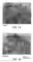 Fig. 02 - Nucleophosmin directed diagnostics and therapeutics for multidrug resistant neoplastic disease