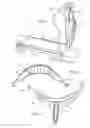 Fig. 02 - Non-motorized treadmill exercise device