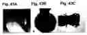 Fig. 44 - Fibroblast growth factor receptors and methods for their use