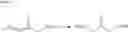 Fig. 15 - Bridged macrocyclic compounds and processes for the preparation thereof