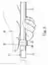 Fig. 07 - Protective sleeve for use with extension bar