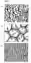 Fig. 07 - Rare earth element-iron-boron alloy and magnetically anisotropic permanent magnet powder and method for production thereof