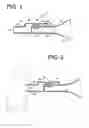 Fig. 02 - Valve stop