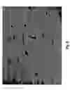 Fig. 09 - Method to induce neovascular formation and tissue regeneration