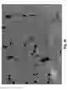 Fig. 11 - Method to induce neovascular formation and tissue regeneration
