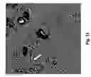 Fig. 12 - Method to induce neovascular formation and tissue regeneration