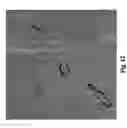 Fig. 13 - Method to induce neovascular formation and tissue regeneration