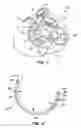 Fig. 02 - Mitral valve therapy device, system and method