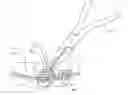 Fig. 01 - Twist on orthodontic hook