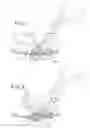 Fig. 03 - Twist on orthodontic hook