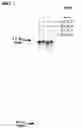 Fig. 13 - Nucleic acid molecules with reduced secondary structure