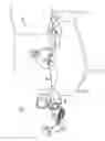 Fig. 02 - Catheter with electrode strip