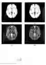 Fig. 09 - Combined magnetic resonance data acquisition of multi-contrast images using variable acquisition parameters and k-space data sharing