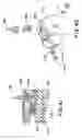 Fig. 23 - Infusion apparatus with modulated flow control