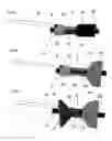 Fig. 02 - Pyloric valve corking device and method