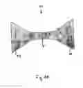 Fig. 06 - Pyloric valve corking device and method