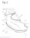 Fig. 02 - Post surgical foot warmer