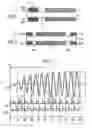Fig. 02 - Transmission coil system and remote control for a hearing aid