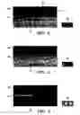 Fig. 03 - System and method for segmenting an electronic image