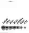 Fig. 06 - DNA sequence encoding a retinoic acid regulated protein