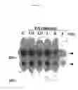 Fig. 07 - DNA sequence encoding a retinoic acid regulated protein