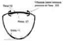 Fig. 01 - Method and apparatus for active control of golf club impact
