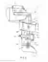 Fig. 07 - Apparatus for correction of leg deformities