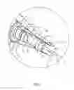 Fig. 04 - Tool for deploying an anastomosis device