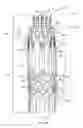 Fig. 15 - Tool for deploying an anastomosis device