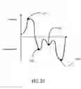 Fig. 27 - Tool for deploying an anastomosis device