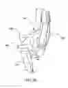 Fig. 33 - Tool for deploying an anastomosis device