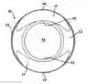 Fig. 01 - Rotationally stabilized contact lenses