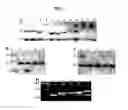 Fig. 02 - Methods and primers for diagnosing idiopathic congenital central hypoventilation syndrome