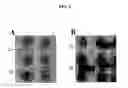 Fig. 04 - Methods and primers for diagnosing idiopathic congenital central hypoventilation syndrome