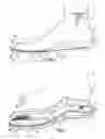 Fig. 02 - Foot orthotic