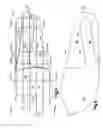 Fig. 03 - Foot orthotic