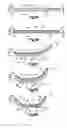 Fig. 04 - Foot orthotic