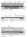 Fig. 49 - Nozzle with reciprocating plunger