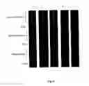 Fig. 09 - Method of making and using hybrid polymeric thin films for bio-microarray applications