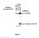 Fig. 07 - Caspase-8 binding protein, its preparation and use