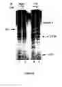 Fig. 08 - Caspase-8 binding protein, its preparation and use
