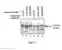 Fig. 12 - Caspase-8 binding protein, its preparation and use