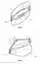 Fig. 02 - Disposable mask for dust protection