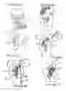 Fig. 06 - Hair styling devices and methods