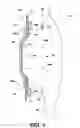 Fig. 07 - Ostomy appliance