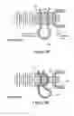 Fig. 07 - Knotless suture anchor