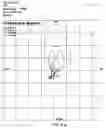 Fig. 22 - Determining clinical refraction of eye