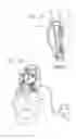 Fig. 11 - Tissue stabilization system